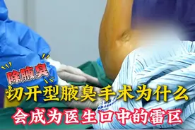 切开型腋臭手术为什么会成为医生口中的雷区#腋臭 #狐臭 #腋臭微创手术 #腋臭狐臭 #医美