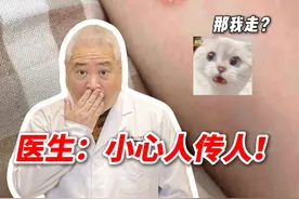 抱猫后手臂长红斑，竟然染上这个麻烦病！ #科普 #硬核健康科普行动  #猫癣 #宠物 #体癣视频封面