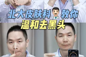 皮肤科医生手把手教你去黑头，简单干净不走弯路#去黑头 #挤黑头 #黑头粉刺 #抖出健康知识宝藏 #解压