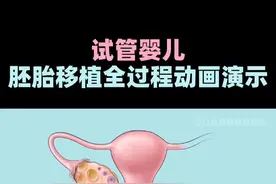 胚胎移植全过程动画演示 仅作医学科普 无不良引导 #科学备孕 #试管 #硬核健康科普行动 #胚胎移植过程 #试管移植视频封面