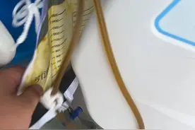 胆汁真的能喝吗？#胆结石 #胆汁能喝吗 #医学科普视频封面