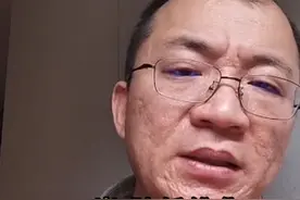 25岁肺纤维化，还年轻不要悲观着急，更不要瞎百度吓自己 #肺纤维化 #慢阻肺 #抖出健康知识宝藏 #开工去班味健康指南