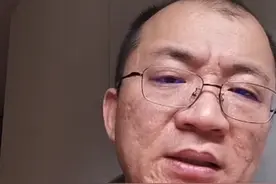 25岁肺纤维化，还年轻不要悲观着急，更不要瞎百度吓自己 #肺纤维化 #慢阻肺 #抖出健康知识宝藏 #开工去班味健康指南视频封面