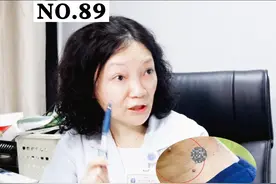脖子和腋下长了小肉粒，可不一定是#HPV  感染引起的#丝状疣 ！不要太担心！这种光滑的小肉粒不传染！#诊室日常 #女性 #老年人 视频封面