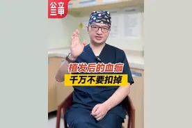 植发后的血痂，千万不要扣掉 #植发 #毛发种植 #发际线种植 #江华医生团队 #脂溢性掉发