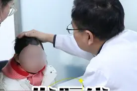 头顶黑痣 #黑痣 #头顶黑痣 #黑痣凸起来正常吗 #抖出健康知识宝藏  #医者视频封面