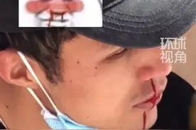  4月5日，新疆。男生看到女生路过突然流鼻血，当事人解释：我可能是吃饭中暑了，网友：你那是中暑么都不好意点破你视频封面