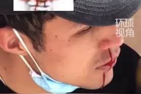  4月5日，新疆。男生看到女生路过突然流鼻血，当事人解释：我可能是吃饭中暑了，网友：你那是中暑么都不好意点破你视频封面
