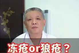 这不是冻疮!而是系统性红斑狼疮! 一定要注意区分!系统性红斑狼疮多发于15-40岁的女性，早发现早就医!#作品同步头条赢激励 #医疗健康创作训练营 #健康冷知识知多少视频封面