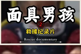 男童出生便拥有两张脸，常被人视为怪物，只因母亲孕期做了这件事视频封面