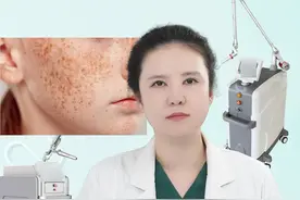 雀斑和遗传性雀斑怎么治疗？ #雀斑 #遗传性雀斑 #祛斑 #淡斑 #硬核健康科普行动