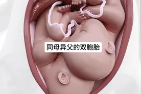 为什么同一个母亲生下的双胞胎却有两个不同的父亲？#双胞胎视频封面