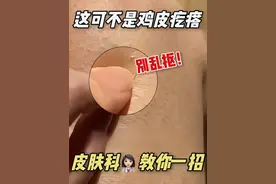 手臂、大腿上疙疙瘩瘩很难看，皮肤科医生教你低成本处理#鸡皮#鸡皮疙瘩#变美#硬核健康科普行动10%#尿素身体乳视频封面
