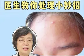 额头上长疙疙瘩瘩的闭口粉刺，很影响美观，今天皮肤科医生教你3步正确处理法#医学科普 #科普 #闭口 #痘痘 #变美