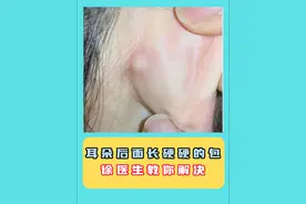 耳朵后面长硬硬的包，徐医生教你解决 耳朵后面长硬硬的包，不要硬挤，徐医生教你解决 #医学科普 #火疖子 #皮脂腺囊肿 #硬核健康科普行动视频封面