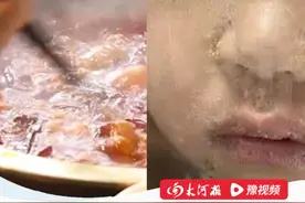 郑州3岁男童吃火锅后全身溃烂，医生警告：会传染。3岁小孩不能吃火锅？评论区吵翻了#河南好医声视频封面