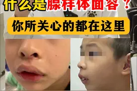 什么是腺样体面容？你所关心的都在这里 #硬核健康科普行动 #腺样体肥大 ##医疗健康创作训练营 #腺样体面容视频封面