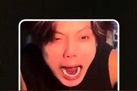 原来中国人的骨子里，就不认为自己是会过敏的！ #缺牙齿