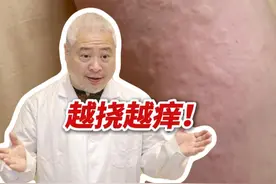 好冷啊！怎么还长蚊子包了？ #科普 #寒冷性荨麻疹 #荨麻疹 #冬天 #抖出健康知识宝藏视频封面