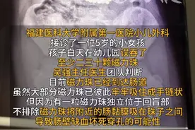 #福州  5岁娃吞下38颗#磁力珠  ，在#肠道  里吸附成一串手链，医生：会将肠黏膜牢牢吸住，致坏死甚至穿孔
#孩子   #玩具视频封面