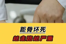 距骨坏死，越走路越严重 #医学科普视频封面