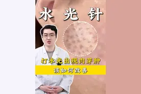 打水光出现肉芽肿，该如何改善 #水光肉芽肿 #改善 #北医三院张辰博士 #水光针