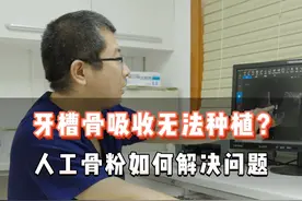 牙槽骨吸收会影响种植牙，但我们也有对策，那就是人工骨粉#种植牙 #健康科普
