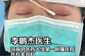 双眼皮术后6天拆线、拆线后注意事项。 #双眼皮 #变美那些事 #郑州双眼皮李朋杰 #双眼皮手术 #郑州双眼皮视频封面