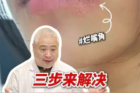 冬天烂嘴角，又肿又痛还开裂，医生教你三步来解决 #口角炎 #嘴唇干裂 #硬核健康科普行动  #入冬换季不患疾 #科普视频封面