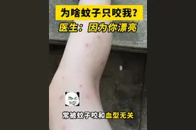 正式确诊为美女！原来经常被蚊子咬是因为长得漂亮好看？ 竟然和血型无关！#蚊子 #驱蚊 #蚊虫叮咬 #硬核健康科普行动  #冷知识