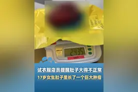 17岁女孩试衣服店员提醒她肚子大得不正常，就医检查竟发现肚子里长了个27厘米肿瘤！（第一现场）#大象主播说 @程鹏视频封面