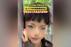 8岁女孩异瞳双眼成蓝色，五、六个月时眼睛慢慢变蓝 #蓝眼睛的女孩 #瓦登伯格综合征
