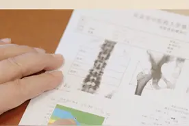 今天教大家怎么看骨密度报告单 #医学科普 #骨密度报告 #骨科专家 #股骨头坏死 #股骨头坏死专家陈卫衡