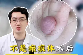 不是瘢痕体，术后也可能出现瘢痕疙瘩 #瘢痕 #耳垂瘢痕疙瘩 #北医三院张辰博士视频封面