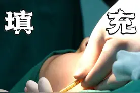 自体脂肪是不是永久的，和假体填充有什么区别 #自体脂肪移植 #八大处金骥 #假体下巴 #门诊日常视频封面
