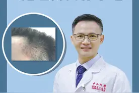 你头上有这种一碰就痛的“痘痘”吗？处理其实并不难！#医学科普 #毛囊炎 #健康视频封面