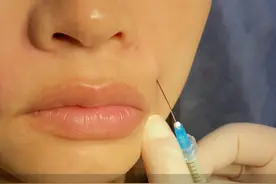 少女针、童颜针分别治疗什么？ #少女针 #童颜针 #轮廓提升 #抗衰老 #紧致提升淡化皱纹