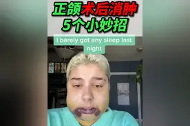 #正颌 #正颌手术记录 #刘琦武大口腔正颌