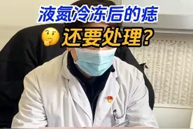 有些痣处理后再次出现该如何处理 #黑痣 #医生日常 #诊室日常视频封面