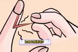 指甲旁边长为啥会长倒刺？#热点 #热点知多少 #热点小助手视频封面