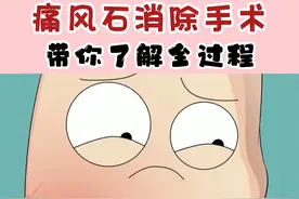 带你了解痛风石消除过程#痛风 #痛风石 #高尿酸 #健康科普视频封面