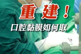 先天性尿道下裂从1982年开始，整形外科医院一直在做，我们这么多年大概做了有6000多例，口腔黏膜治疗尿道下裂，是经过N多次手术实验，证实了可以完整存活，色泽与颜色都更接近正常尿道。#医学科普视频封面