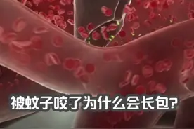被蚊子咬了为什么会长包，而且还这么痒？ #知识科普