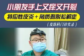 小朋友手上又痒又开裂，是怎么回事#特应性皮炎 #皮肤科 #硬核健康科普dou来说视频封面
