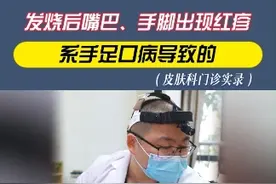 发烧后，嘴巴、手脚出现红疹，是怎么回事 #硬核健康科普行动  #手足口病 #皮肤科 #健康 #儿童视频封面