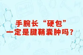 手腕长包是怎么回事#医学科普仅供参考如有不适请线下就医 #腱鞘囊肿 #运动医学视频封面