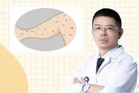 小孩发烧后身上为什么会起红点？#医学科普 #宝宝发烧