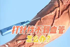 打针找不到血管怎么办？ #科普