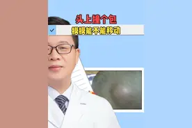 不小心头上撞个包，7天之后还不消，在家摸摸包块能不能移动？#四川  #健康  #医学科普视频封面