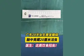 广东广州。28岁女生屡发癫痫，脑中竟藏了20厘米的活虫，医生提醒：这类饮食招虫！#广州 #广东dou知道 #医学科普 #生活小妙招视频封面